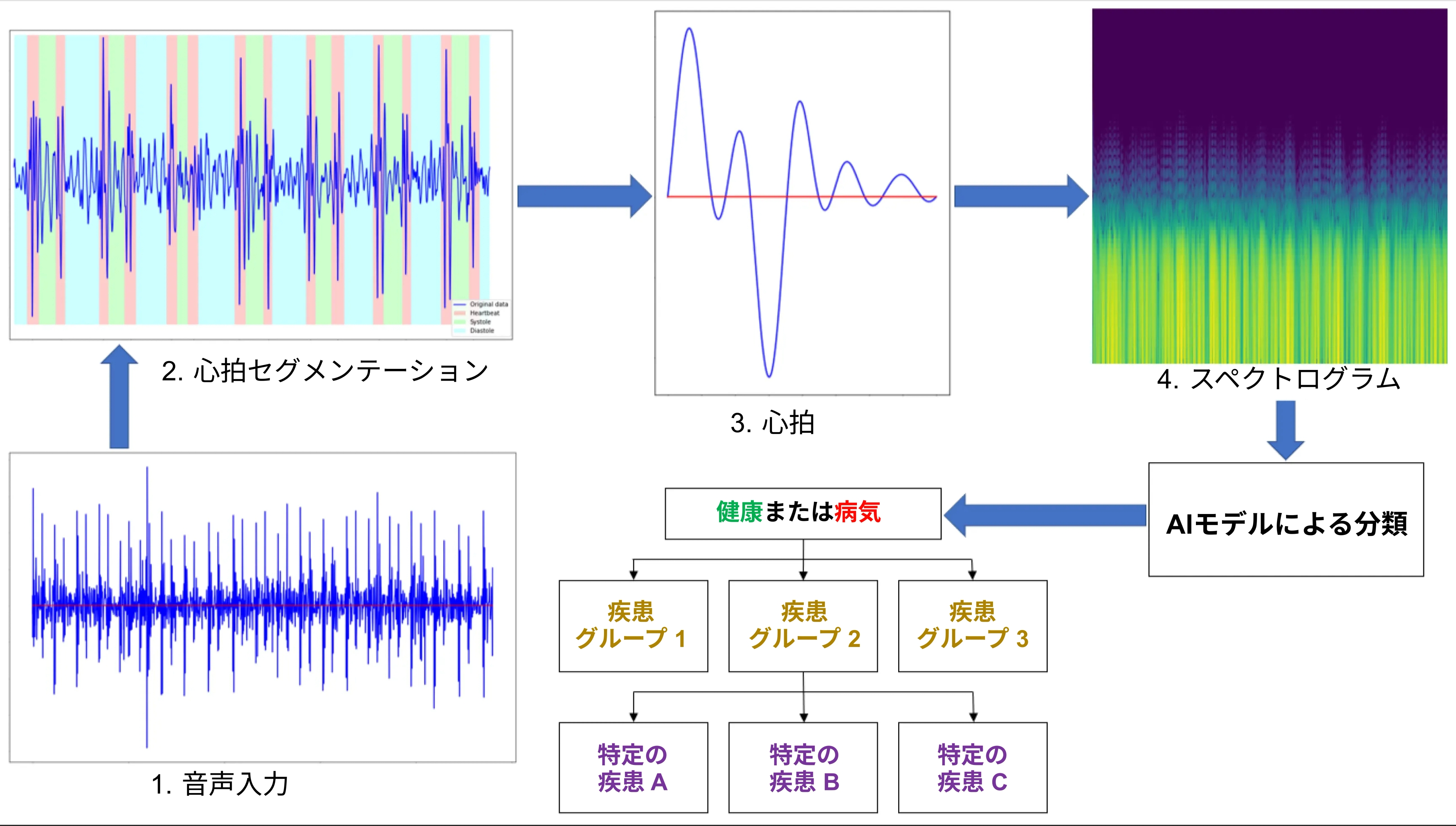心臓病を音で診断するAI
システム